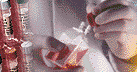 migraine headache symptom cell culture
